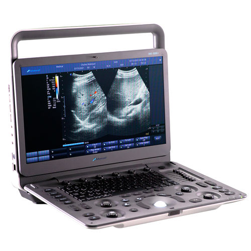 Tragbares Ultraschallgerät - DUS – 5000 + - Advanced Instrumentations - für Ultraschalldiagnostik in Gynäkologie und Geburtshilfe / für bildgebende Ultraschalldiagnostik im Bauch- und Beckenbereich / für Kardiologie
