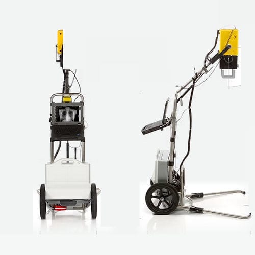 Digitales mobiles Röntgensystem - Fusion DR™ - iCRco