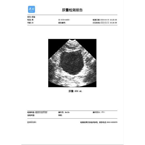 Druck-Software - Mianyang Meike Electronic Equipment - Sicherheit / Kontroll / Urologie