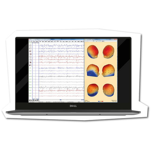 Medizinische Software - BESA - Brainbox - EEG / für Forschungszwecke / Analyse