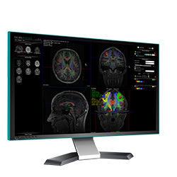 Medizinische Software - nordicBrainEx - NordicNeuroLab - MRT / für Funktions-MRT / Analyse