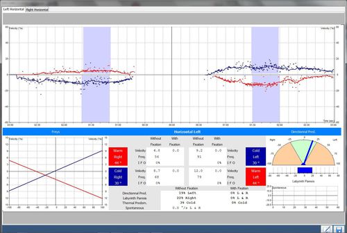 Steuerungssoftware - EASY-Line  - Instrumentation DIFRA - Videoaufnahme / Test / Ausbildung