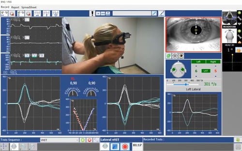 Test-Software - Instrumentation DIFRA - Vestibuläre Rehabilitation