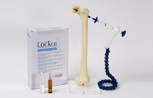 Instrumentenset zur Injizierung von Knochenzement - Locker - Tecres - zum Einmalgebrauch