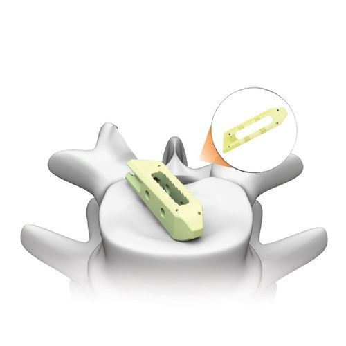 LWS-Zwischenwirbelimplantat - PLATEAU®-LO - Life Spine - transforaminaler Zugang / schräger Zugang