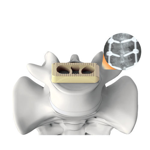 LWS-Zwischenwirbelimplantat - PLATEAU®-X - Life Spine - lateraler Zugang / aus PEEK