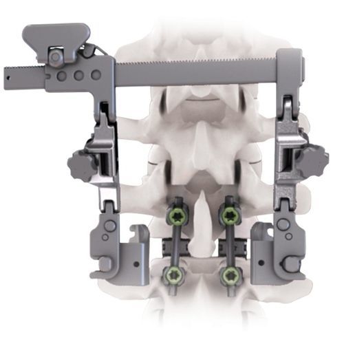 Retraktor für orthopädische Chirurgie - CALYPSO™ - Life Spine