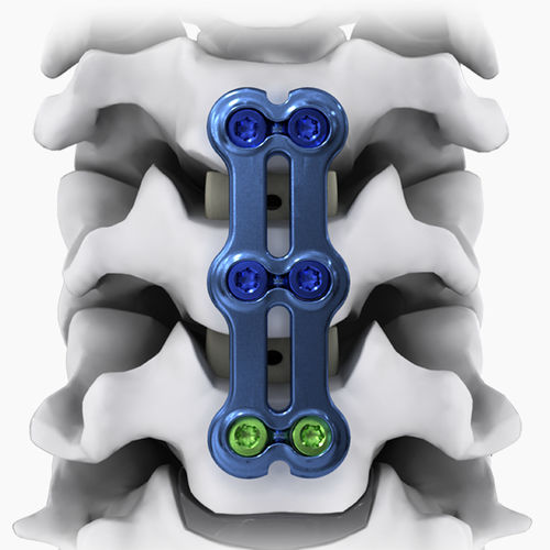 HWS-Arthrodeseplatte - NEO®-SL - Life Spine - mit Verriegelung / Metall / 2 Ebenen