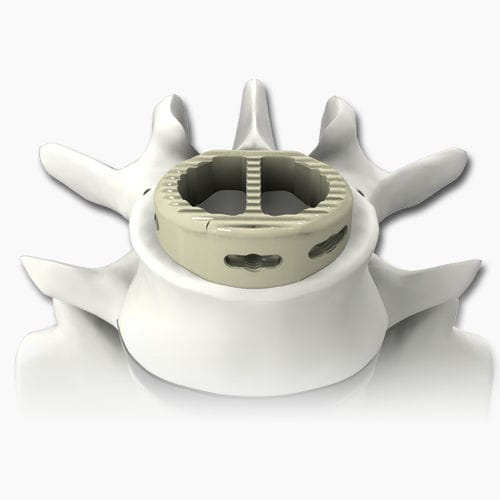 LWS-Zwischenwirbelimplantat - PLATEAU®-A - Life Spine - ventraler Zugang / aus PEEK
