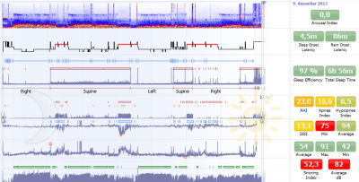 Analysesoftware - Noxturnal™ - Nox Medical - Reporting / Aufzeichnung / für Polysomnografie