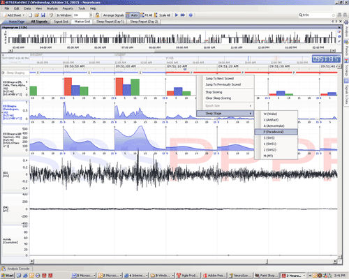 Software für neurophysiologische Stimulation - NeuroScore - DSI - für die Tierforschung / Analyse / Projektentwicklung