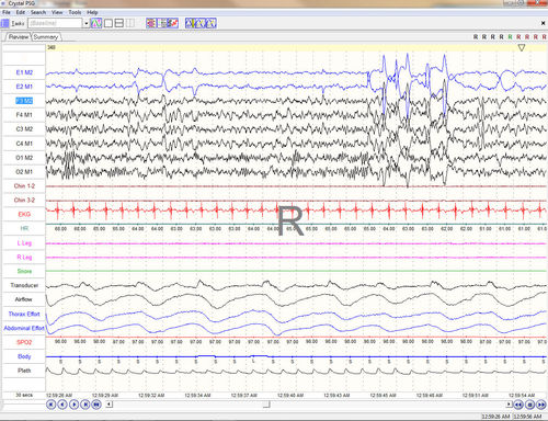 Management-Software - Crystal PSG™ - CleveMed - Reporting / Beschaffung / Aufzeichnung