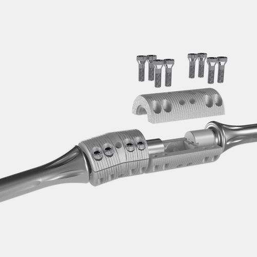 Marknagel für Oberschenkelknochen - OsteoBridge™ - Merete - für Tibia / für Humerus / Titan