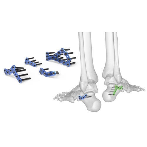 Kompressionsplatte für Calcaneum - 70-0 series - Acumed - seitlich / medial / mit Verriegelung