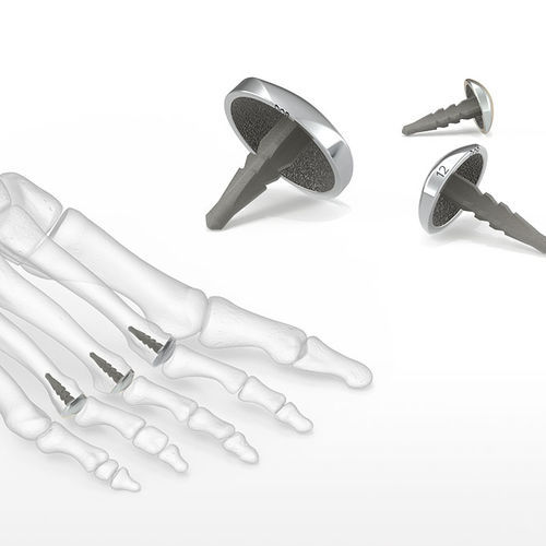 Implantat für Großzehengrundgelenk - EnCompass™ - Acumed
