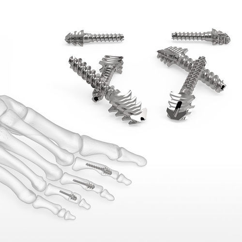 Knochen-Kompressionsschraube / für Metatarsophalangealgelenk - ExtremiFuse™  - Acumed - Metall