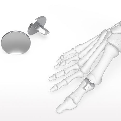 Implantat für Interphalangealgelenk des Fußes - Hemi™ - Acumed - für Großzehengelenk