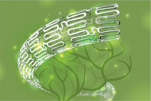 Intrakranieller Stent - NOVA™ - SINOMED - medikamentenbeschichtet