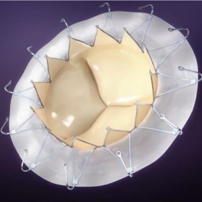 Biologischer Aortenklappenersatz / Mitral - AccuFit® - SINOMED