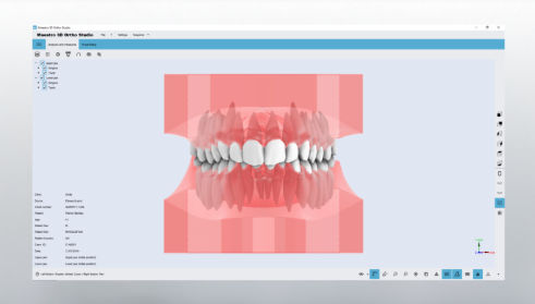 CAD-Software - Studio - AGE Solutions - 3D-Visualisierung / orthodontisch / für Dentallabor