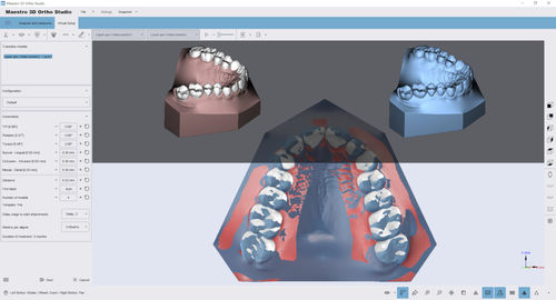 Analysesoftware - Ortho Studio - AGE Solutions - 3D-Visualisierung / Mess / Umform
