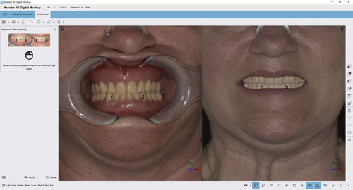 Diagnose-Software - Digital Mockup - AGE Solutions - Umform / Dental