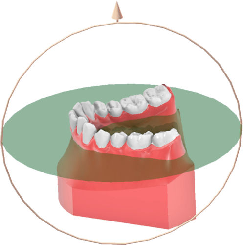 Orthodontische Software - Maestro 3D ortho - Shining 3D - Dental / Analyse / Mess