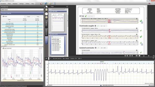 Reporting-Software - RTSoft Ultima - Novacor - Sicherheit / für Kliniken