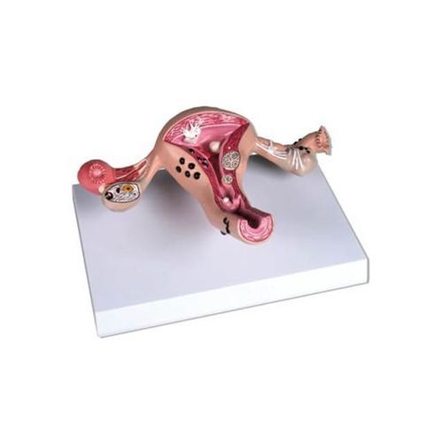 Anatomisches Modell / Gebärmutter - YA/U043B - Yuan Technology - für die Ausbildung