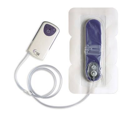 Unterdruck-Wundtherapiesystem / mit Batterie - Prevena™ - Kinetic Concepts