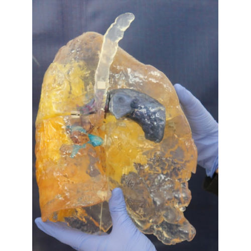 Anatomisches Lungenmodell - ZJY-CVD-70 - Educational + Scientific Products Ltd - COVID-19 / gelb