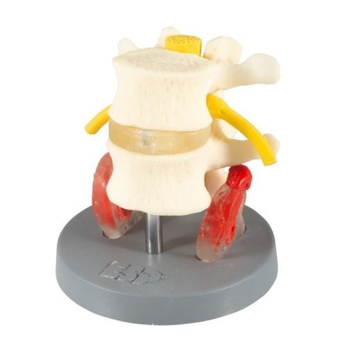 Anatomisches Modell / Rücken - ZJZ-220-D  - Educational + Scientific Products Ltd - Lendenwirbel / mit Nerven