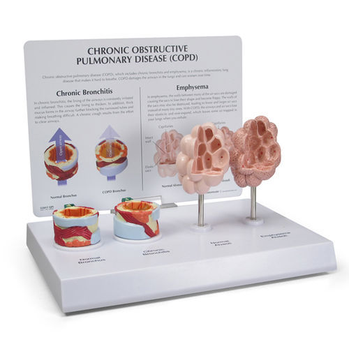 Bronchie anatomisches Modell - 3130 - GPI Anatomicals - für die Ausbildung / für COPD