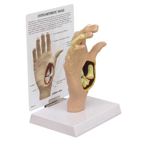 Anatomisches Modell / Knochen - 1930 - GPI Anatomicals - Gelenk / Hand / für die Ausbildung