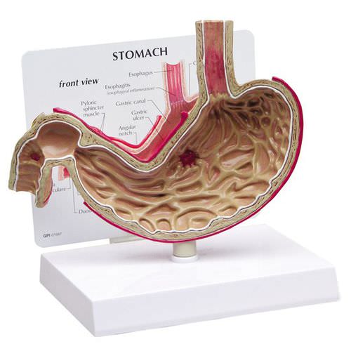 Anatomisches Magenmodell - 2000 - GPI Anatomicals - Zwölffingerdarm / Speiseröhren / für die Ausbildung
