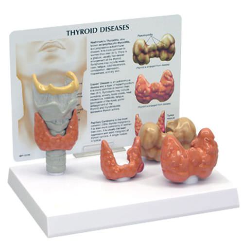 Anatomisches Modell / Larynx - 3150 - GPI Anatomicals - Luftröhre / Schilddrüse / für die Ausbildung