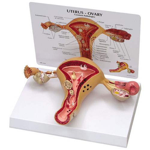 Anatomisches Modell / Gebärmutter - 3480 - GPI Anatomicals - Ovarien / für die Ausbildung / weiblich