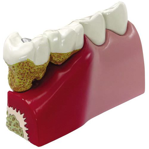 Anatomisches Modell / Zahn - 2860 - GPI Anatomicals - Dental / für die Ausbildung