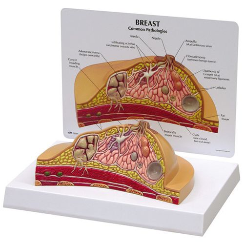 Anatomisches Modell / Brust - 3450 - GPI Anatomicals - für die Ausbildung / für Krebserkrankungen / weiblich