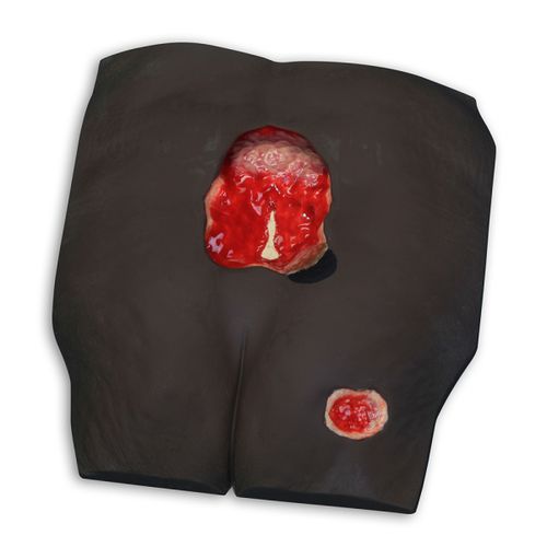 Anatomisches Modell / Knochen - Stan™  - VATA, Inc. - Lumbal-Sakral / Haut / für Dekubitus-Behandlung