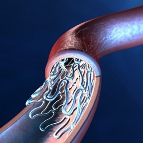 Koronararterien-Stent - CCFlex - eucatech - Kobaltchrom / einfach