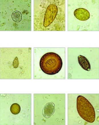 Farbstoff Reagenz - Apacor Ltd. - Parasitologie