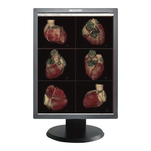 Medizinisch Monitor - C310S - Shenzhen Beacon Display Technology - für medizinische Bildgebung / Diagnose / hochauflösend