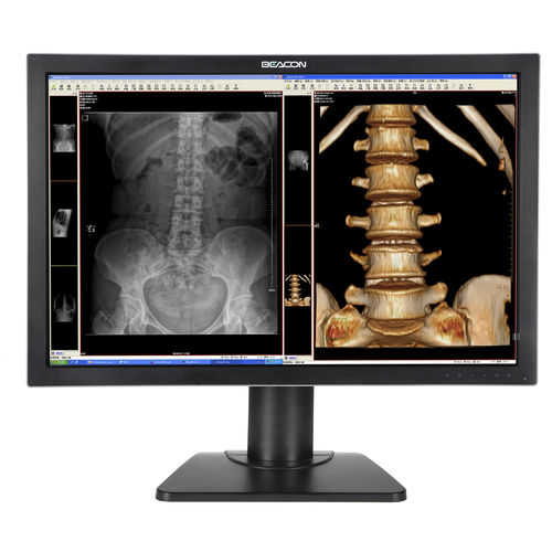 Medizinisch Monitor - C44W+ - Shenzhen Beacon Display Technology - Diagnose / hochauflösend / 30"