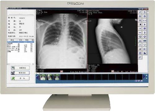 Monitor / 1920 x 1080 - C22W - Shenzhen Beacon Display Technology - 21,5" / LED / DisplayPort