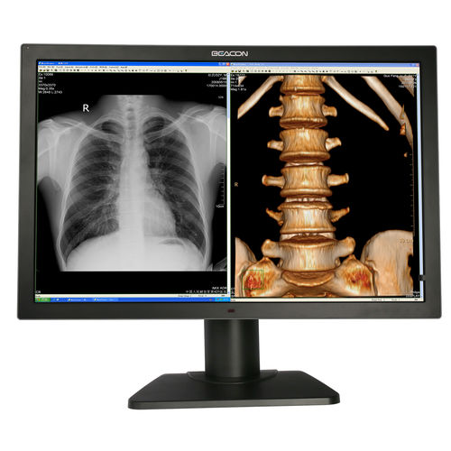 Medizinisch Monitor - C82W+ - Shenzhen Beacon Display Technology - Diagnose / Full HD / 3840 × 2160