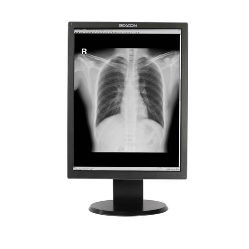 Diagnose-Monitor - G310S - Shenzhen Beacon Display Technology - hochauflösend / 21,3" / mit LED-Hintergrundbeleuchtung