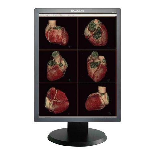 Medizinisch Monitor - C22S+ - Shenzhen Beacon Display Technology - für medizinische Bildgebung / 21,3" / LED