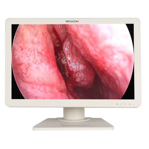Medizinisch Monitor - E2421 - Shenzhen Beacon Display Technology - für OP-Bereich / für Endoskopie / Full HD