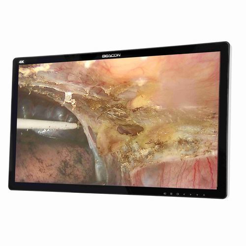 Medizinisch Monitor - S2785P - Shenzhen Beacon Display Technology - OP / 4K / 27"